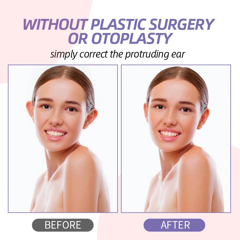 ADHESIVO CORRECTOR DE OREJAS