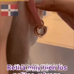 ADHESIVO CORRECTOR DE OREJAS